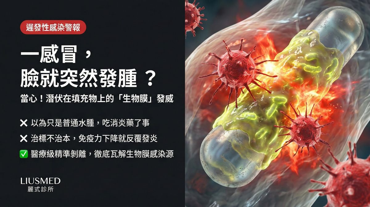 感冒打疫苗後填充物腫脹反覆發作?FILLER REVISION 生物膜感染修復方案