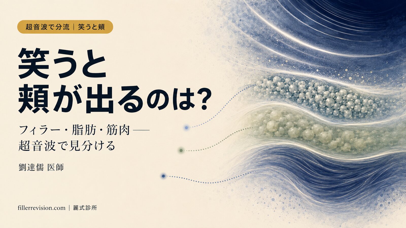 笑うと頬が出る・膨らむのは何が原因？フィラー・皮下脂肪・頬脂肪体・筋肉——超音波で見分けて振り分ける