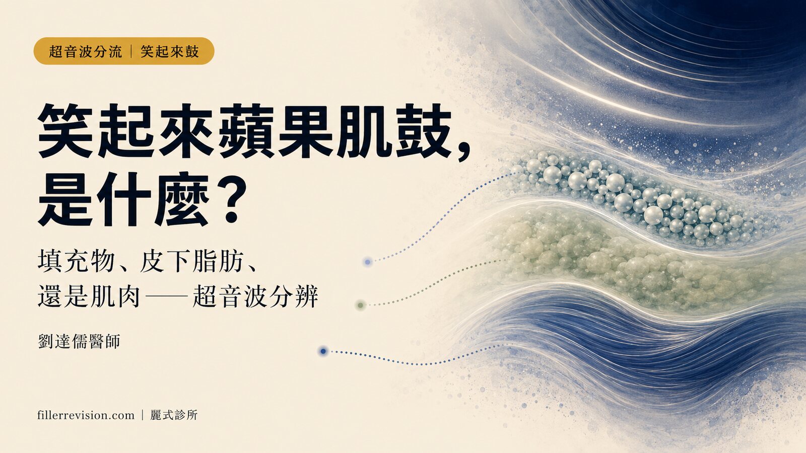 笑起來蘋果肌鼓、突出是什麼原因？填充物、皮下脂肪、頰脂墊還是肌肉——超音波先分辨再分流