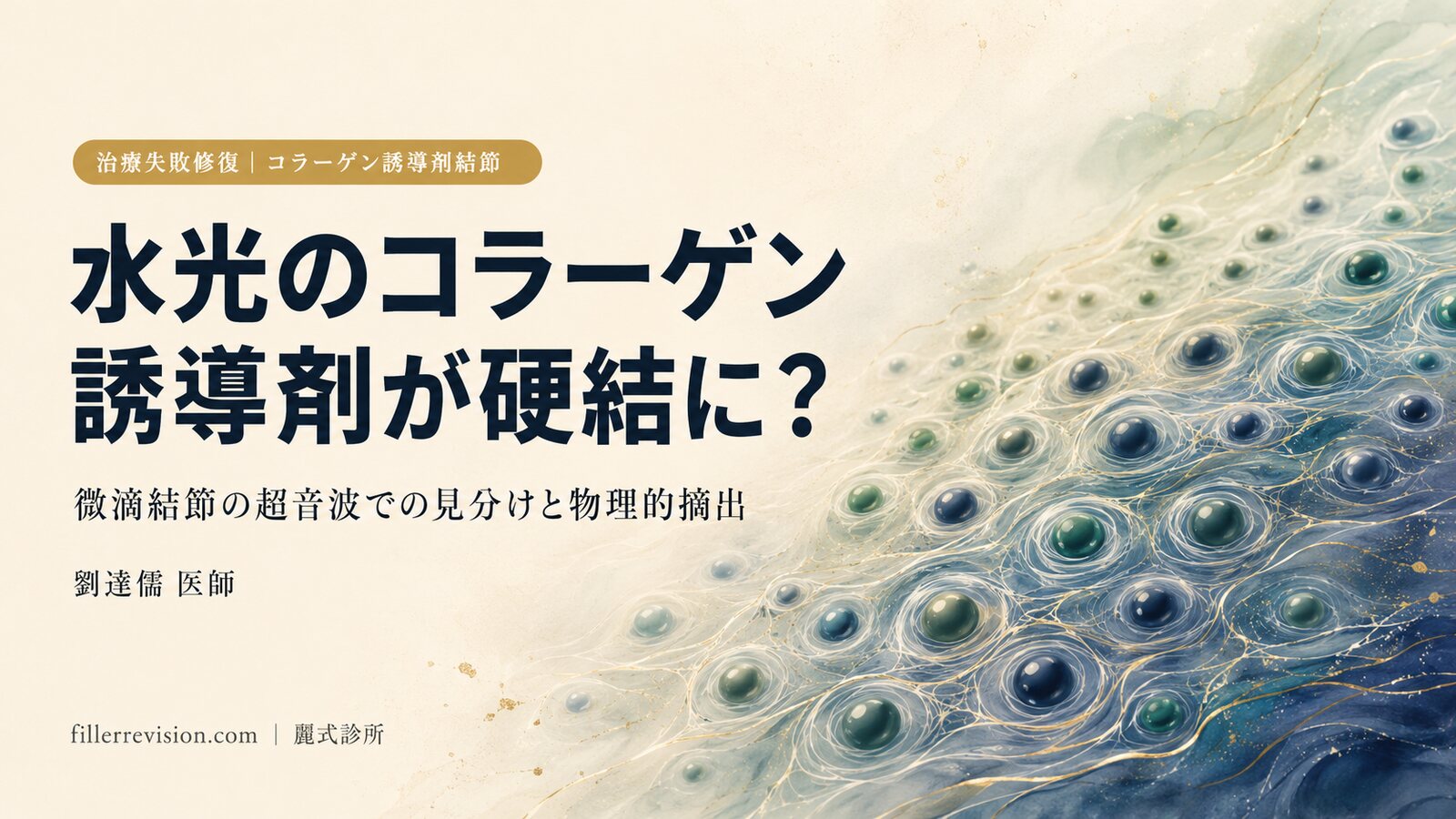 コラーゲン誘導剤を「水光注射」で打って硬結に?スカルプトラ・エランセ・エステフィルの微滴注射による結節の見分け方と摘出