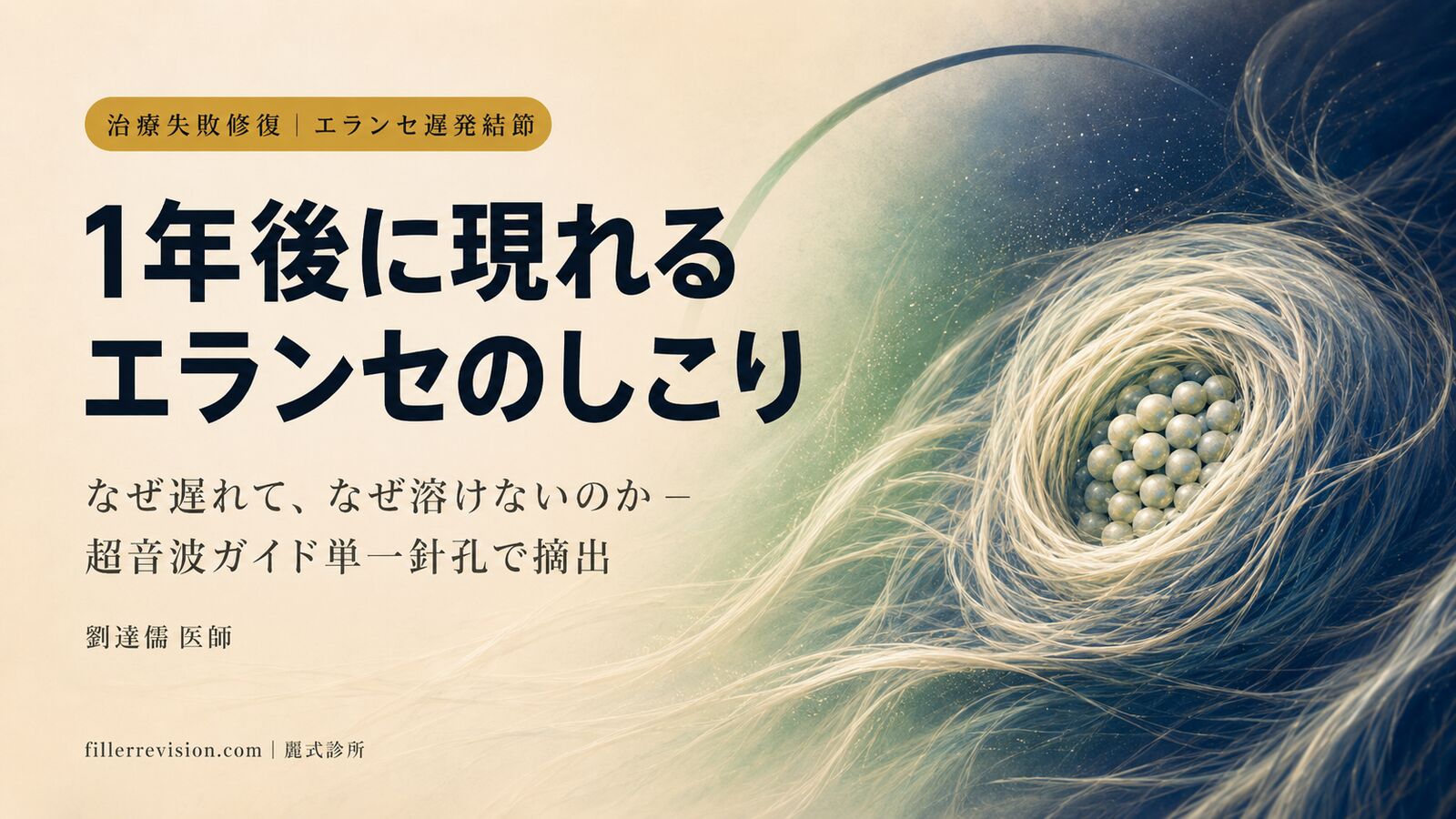 エランセのしこりが1〜2年後に出現?PCL遅発性結節がなぜ遅れて現れるのか、安全な摘出方法