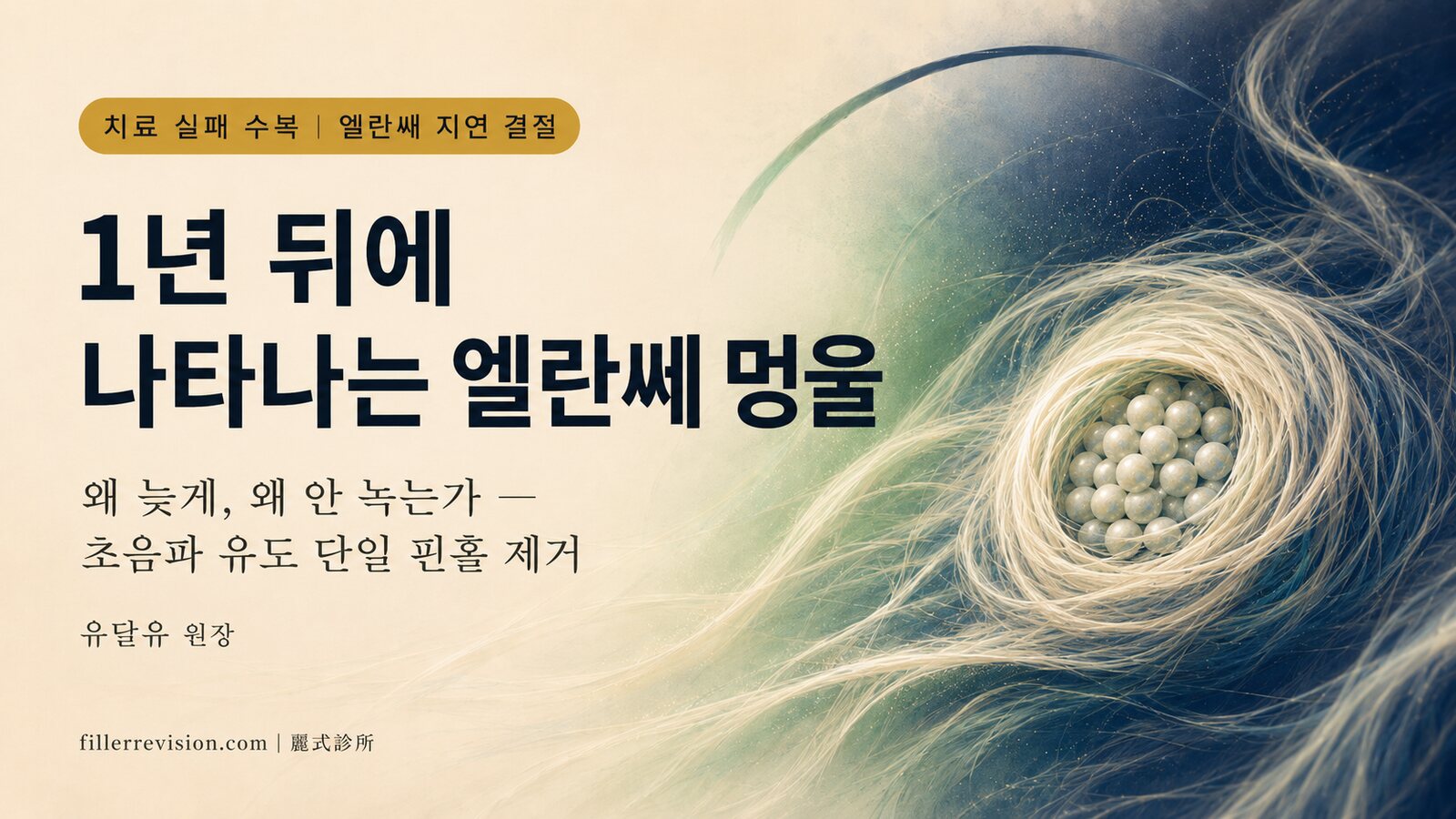 엘란쎄 시술 후 1~2년 뒤에 멍울이? PCL 지연성 결절이 늦게 나타나는 이유와 안전한 제거법