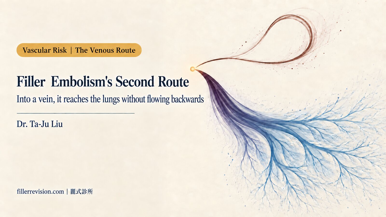 Filler Embolism Has a Second Route: Into a Vein, and It Flows Straight to the Lungs