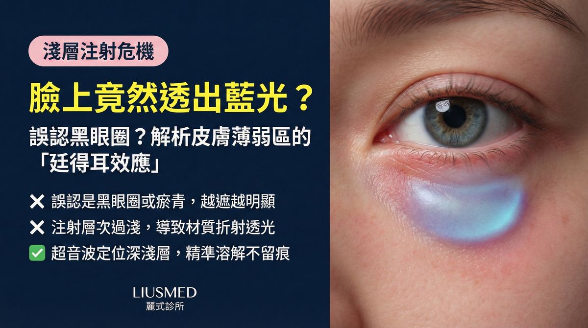 皮膚薄處看得到填充物?FILLER REVISION 填充物透視現象修復方案