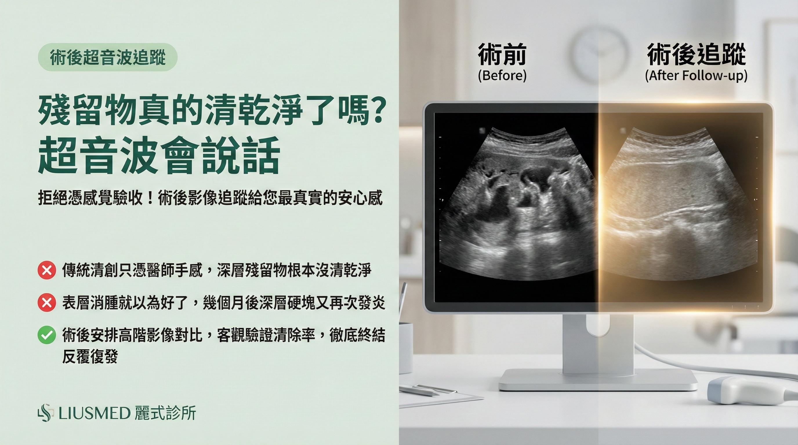 FILLER REVISION 追蹤超音波：二次修復後確認填充物是否完全清除