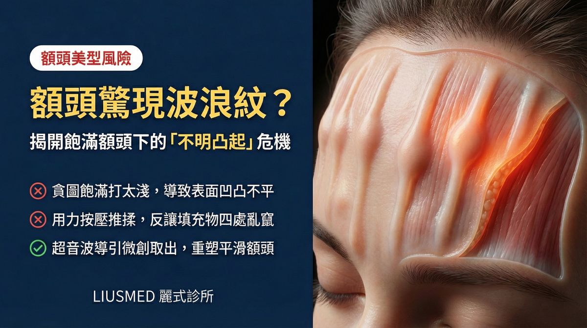 額頭填充物凸起波浪紋路?FILLER REVISION 額頭填充物修復方案