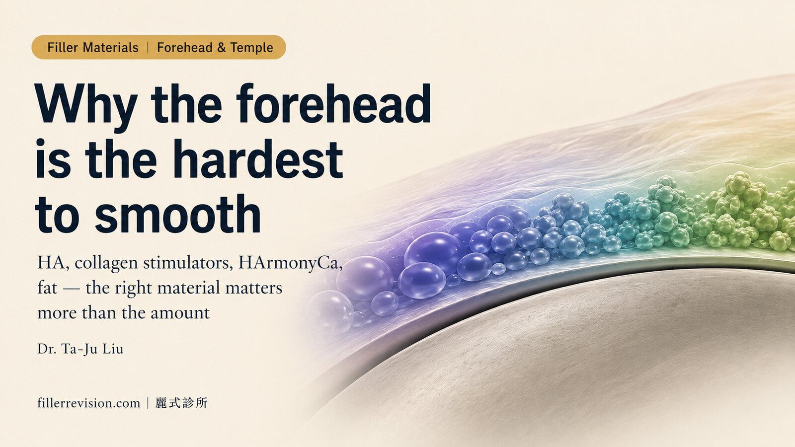 Forehead & Temple Filler Lumps, Unevenness and Overfilling: Why This Zone Is the Hardest to Smooth — A Complete Guide to Materials, Causes and Prevention