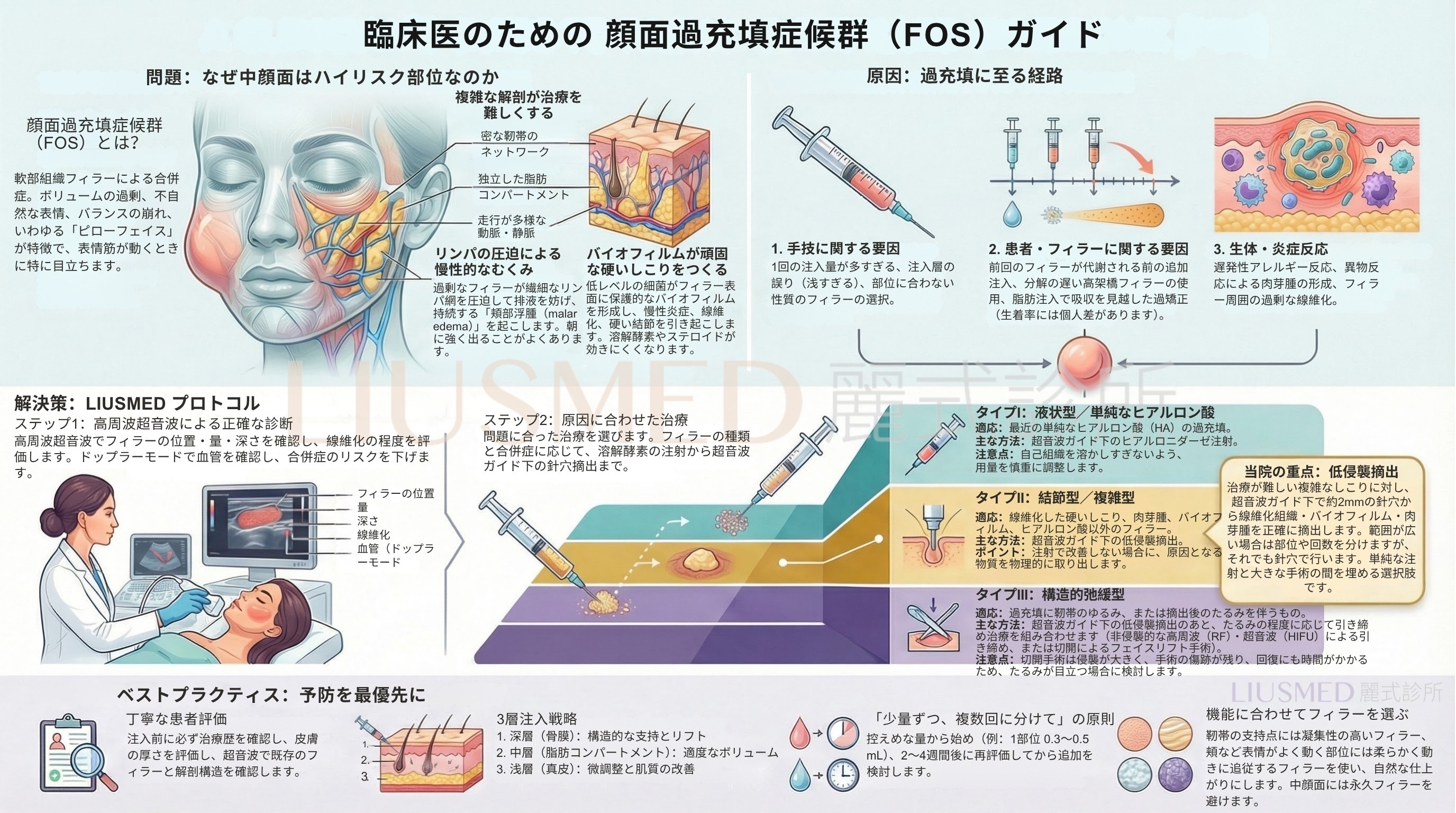 臨床医のための顔面過充填症候群(FOS)ガイド