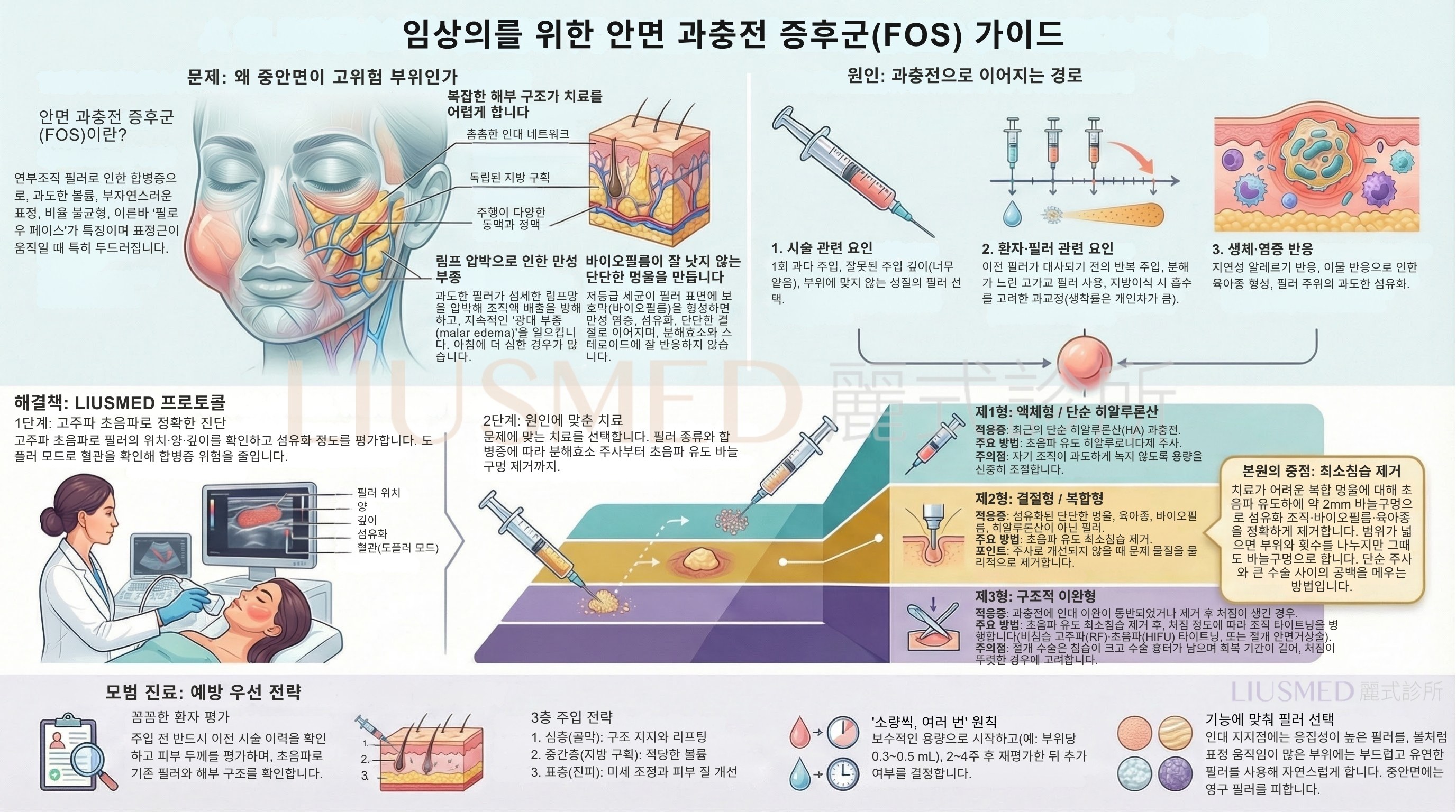 임상의를 위한 안면 과충전 증후군(FOS) 가이드