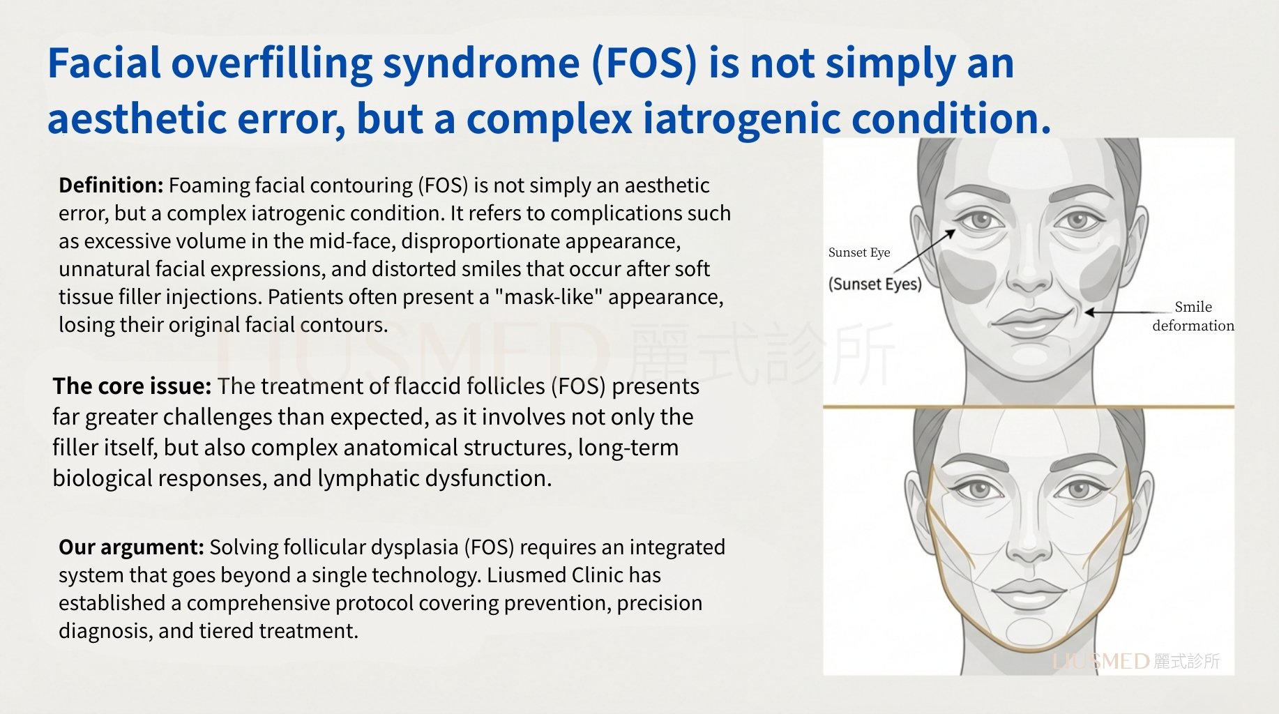 FOS Definition and Core Concepts