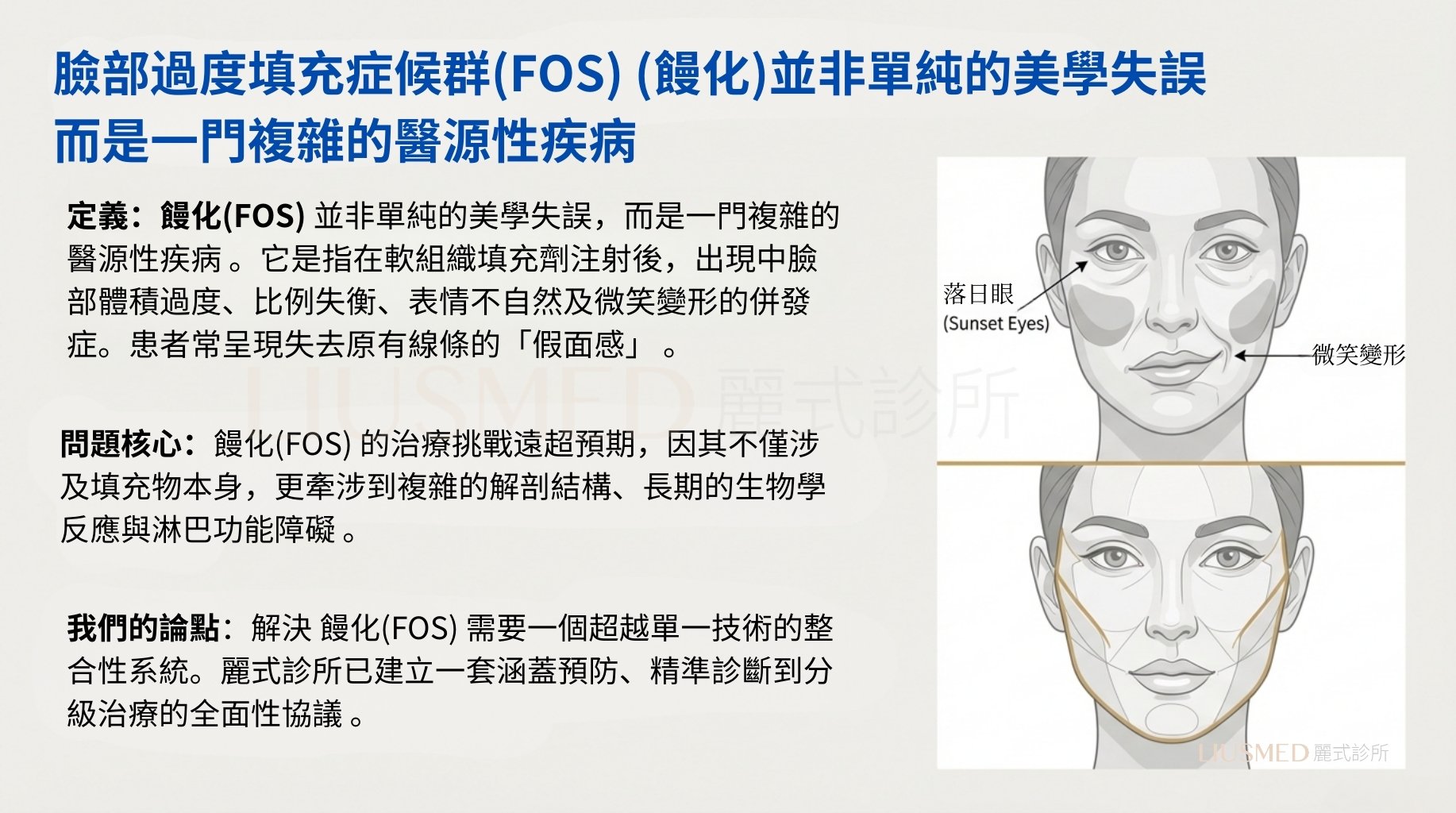 FOS 定義與核心