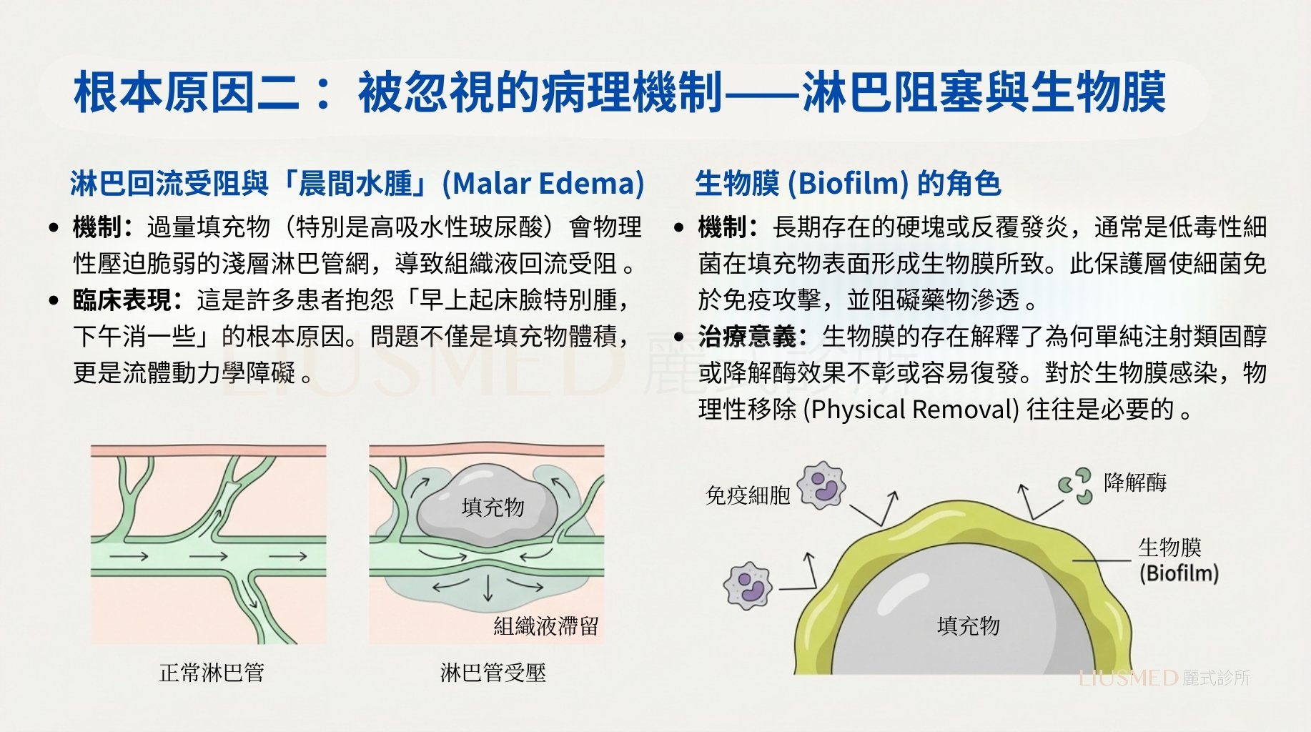 病理機制