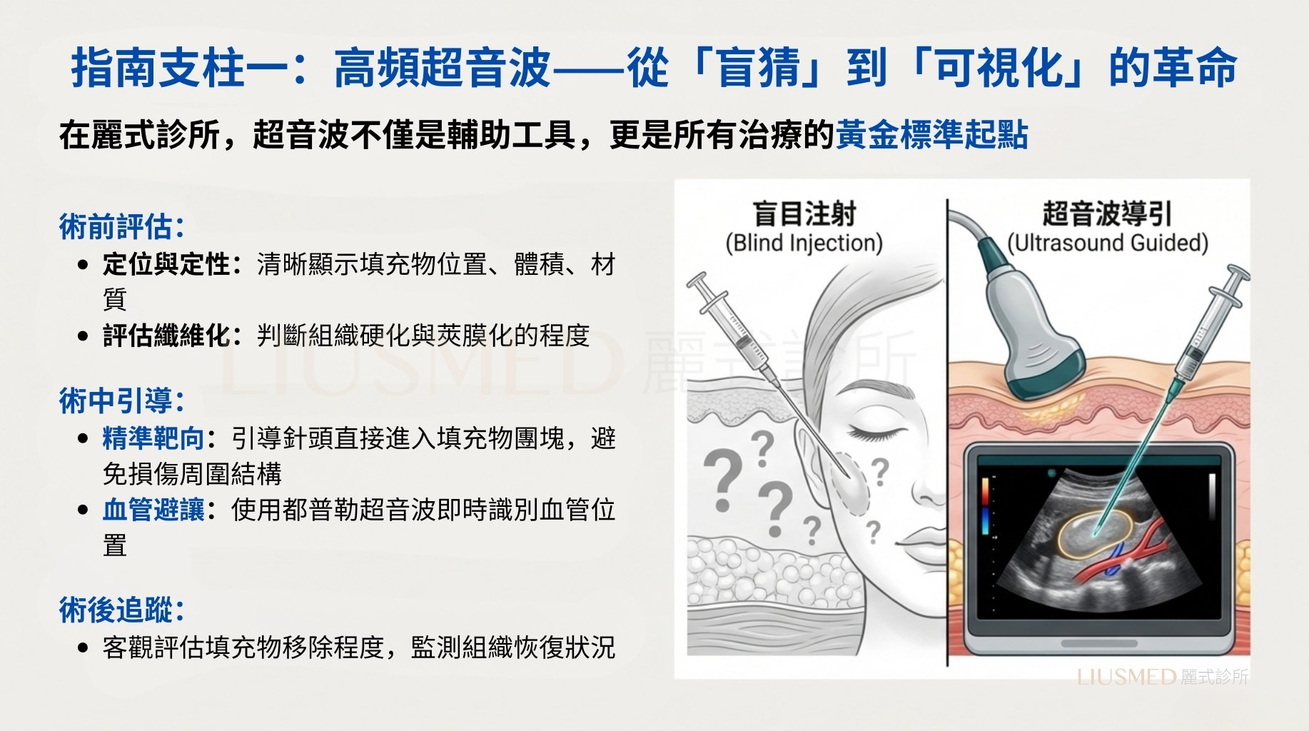 超音波診斷