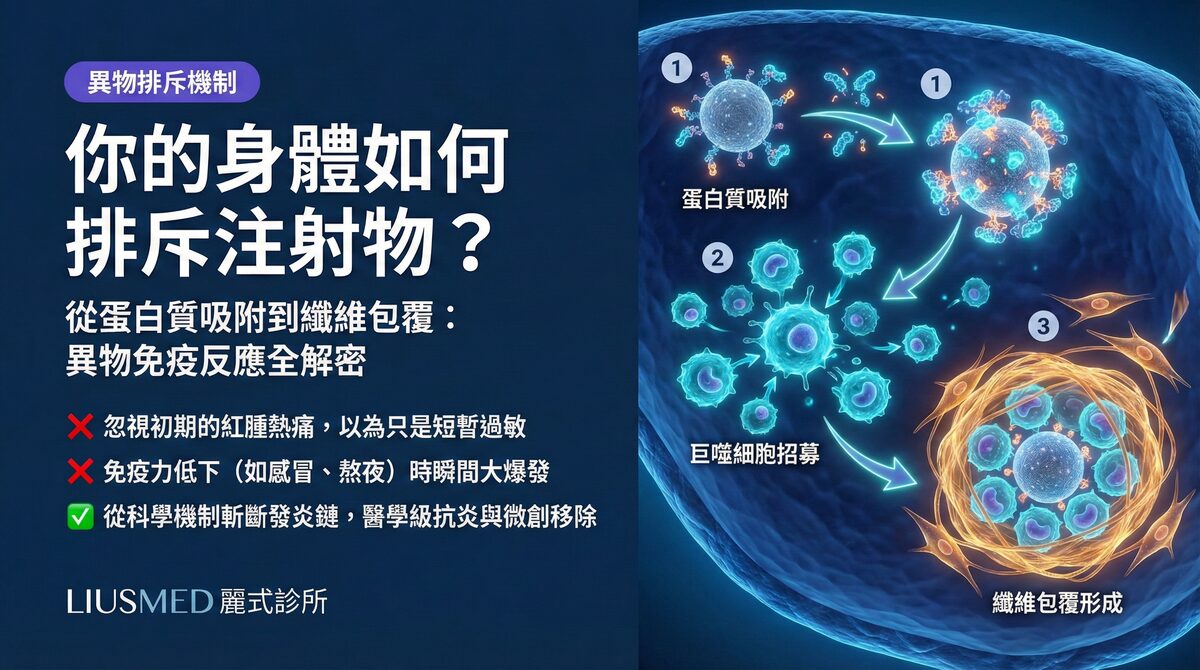 你的身體vs注射物:FILLER REVISION 解析異物免疫反應的完整過程