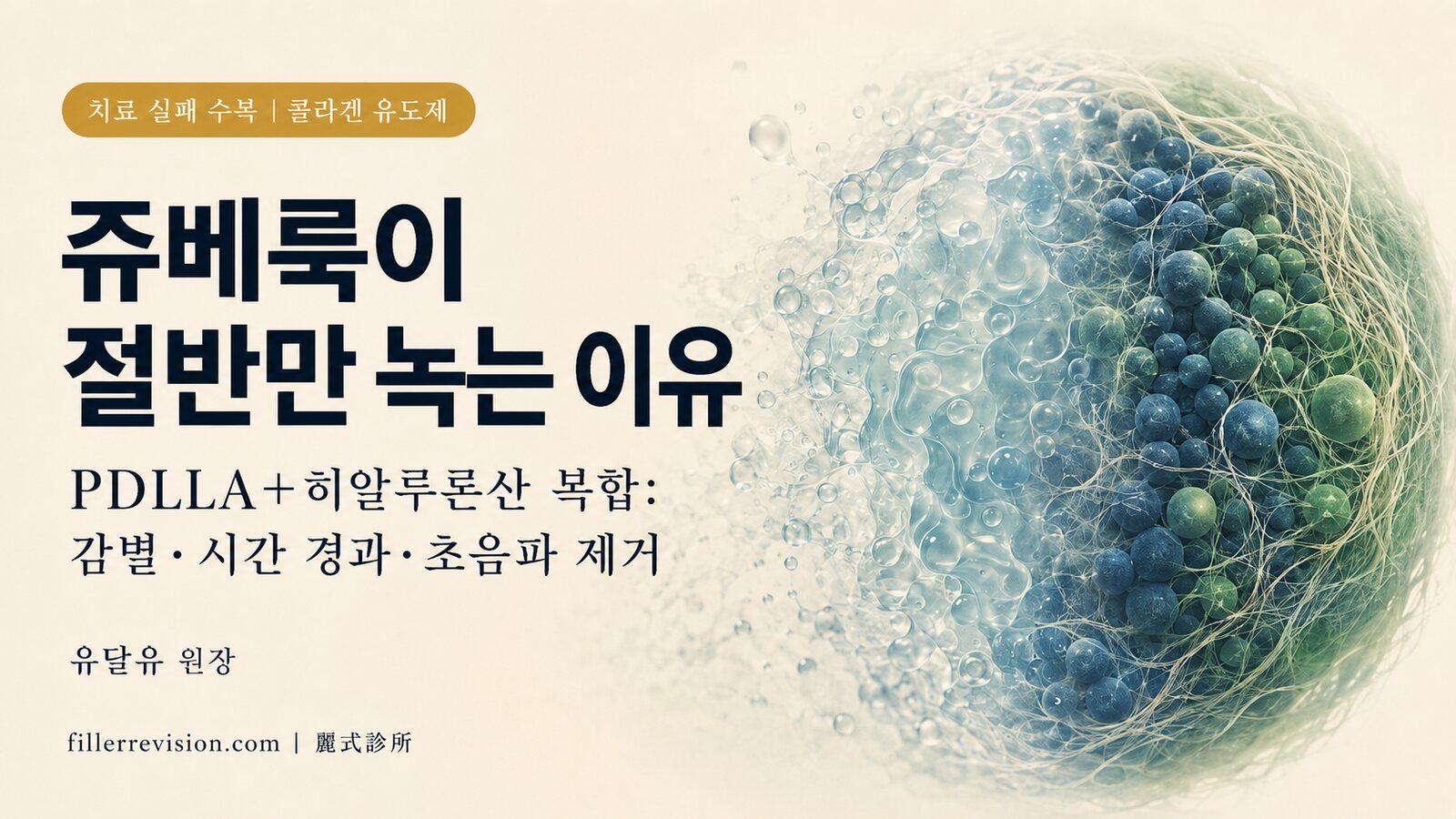 쥬베룩·레니스나 결절과 멍울은 왜 절반만 녹을까? 히알루로니다제가 듣지 않는 이유