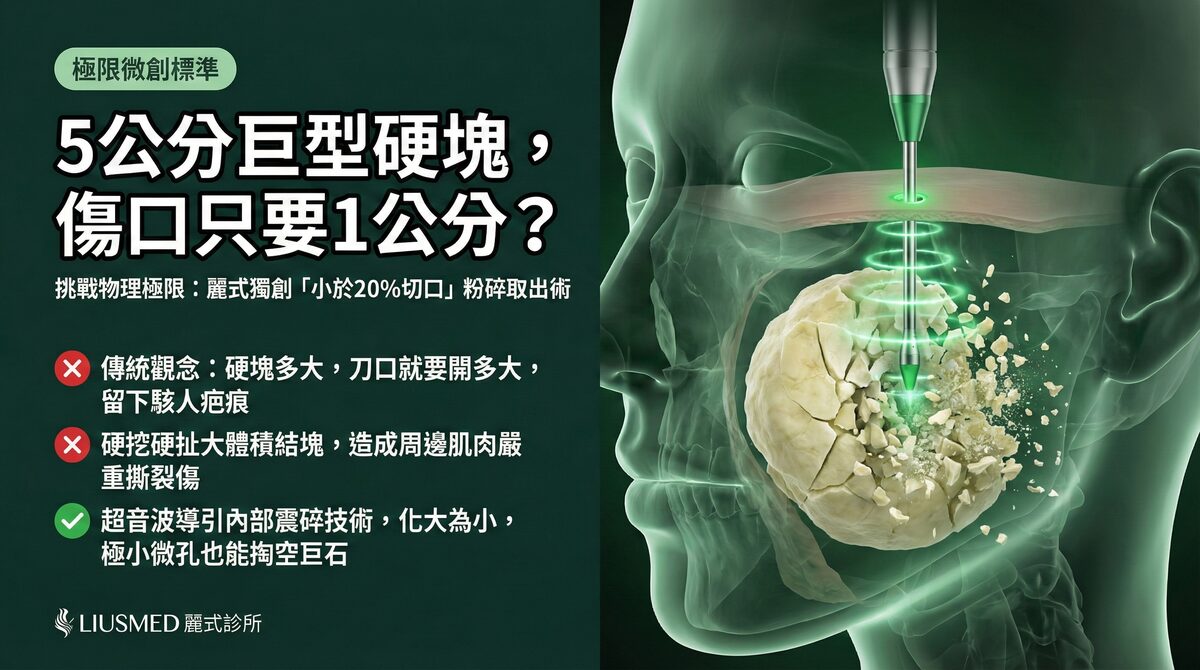 FILLER REVISION「小於20%切口」微創標準:取出5公分硬塊只需1公分傷口?