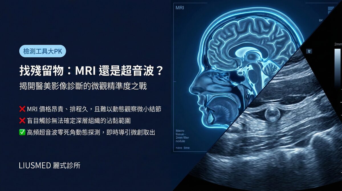 MRI vs 超音波:FILLER REVISION 比較兩種填充物檢查的精準度