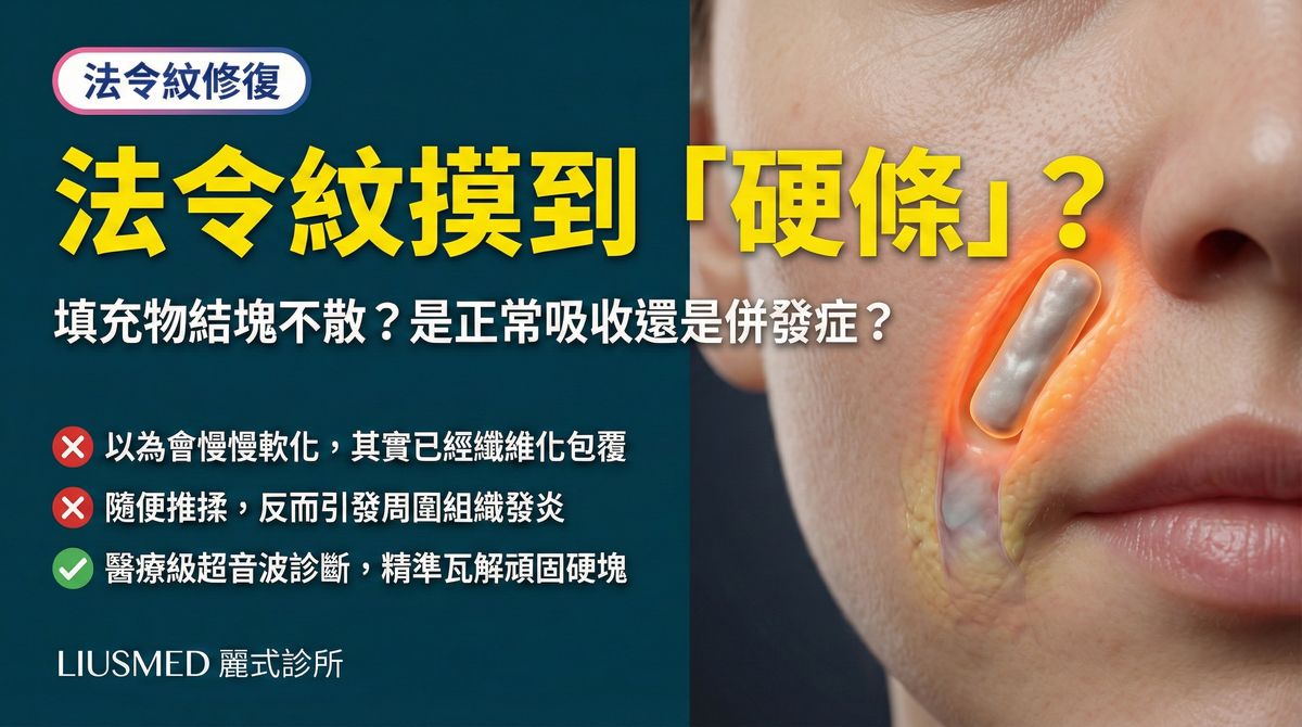 法令紋填充物硬塊條狀物?FILLER REVISION 法令紋併發症修復方案