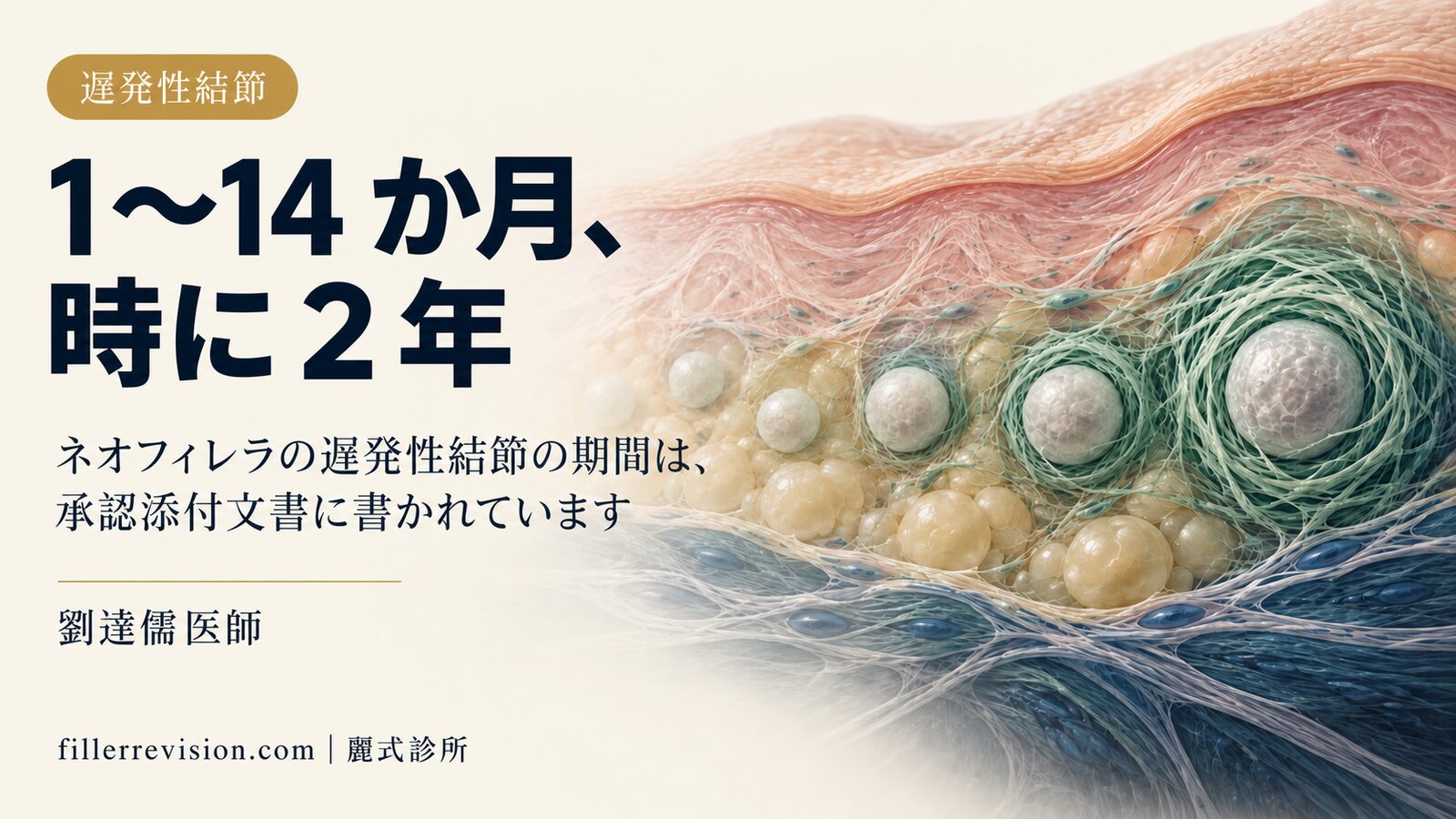 ネオフィレラ後のしこり。添付文書が示す 1〜14 か月という時間