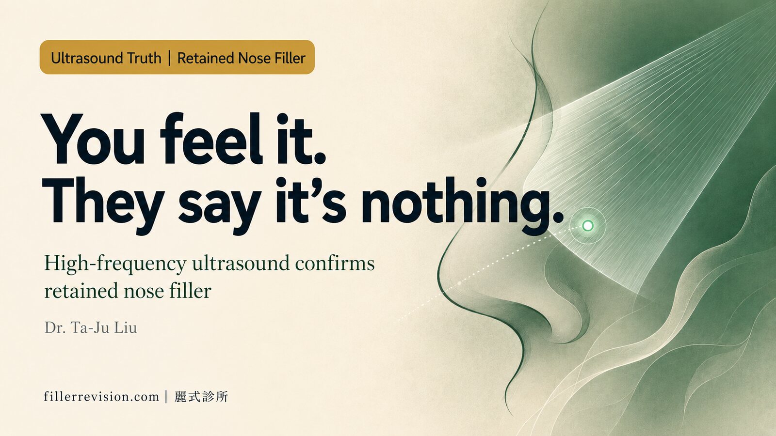 You Feel a Lump, but Your Doctor Says 'There's Nothing There'? How High-Frequency Ultrasound Confirms Retained Nose Filler