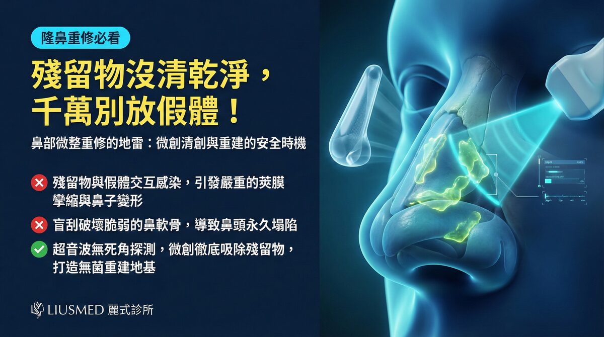 鼻部填充物殘留未清乾淨?FILLER REVISION 的精準取出與隆鼻重建評估