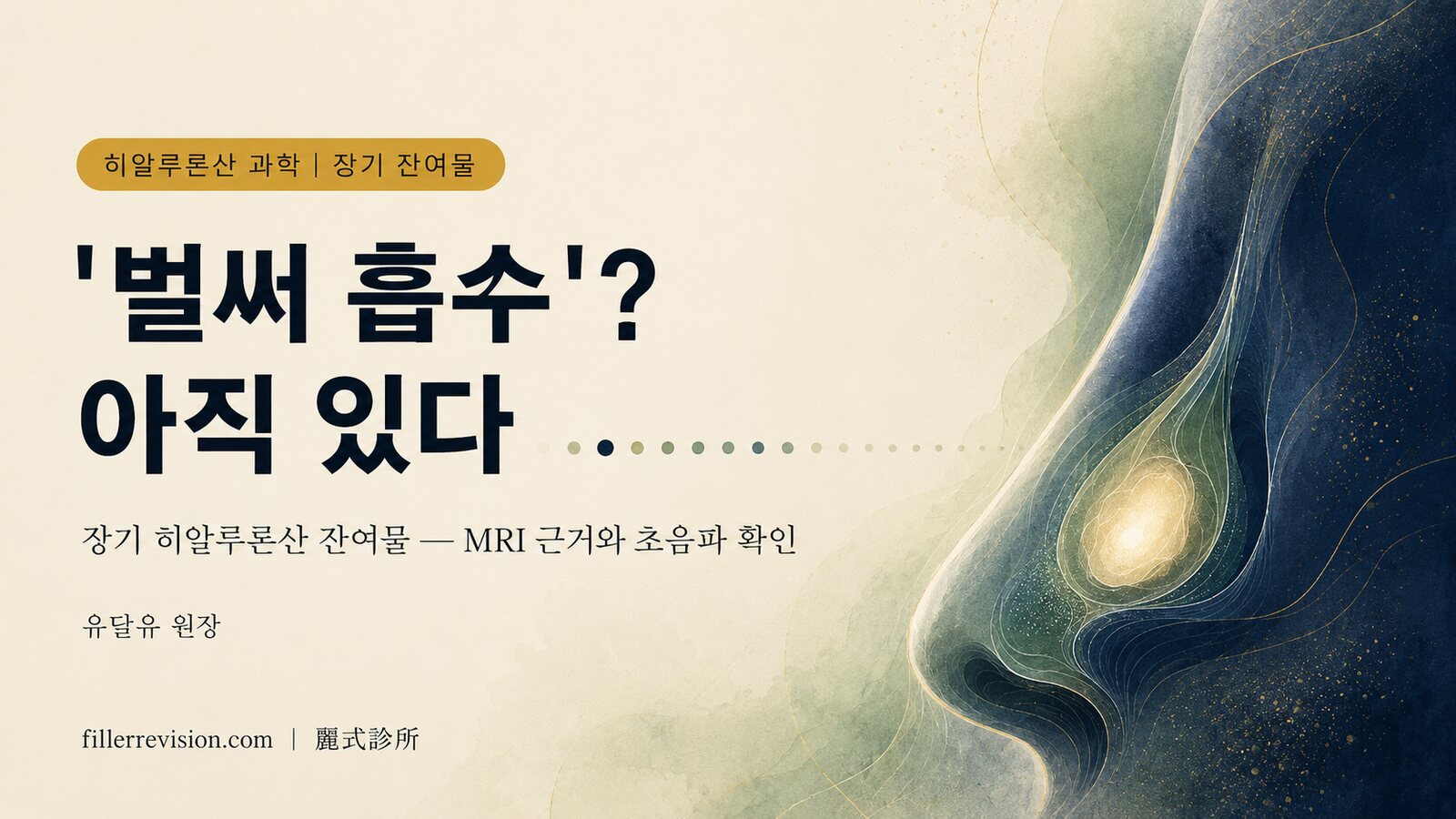 히알루론산 코 필러를 한 지 몇 년인데 아직 만져진다? '완전히 흡수'되지 않는 이유