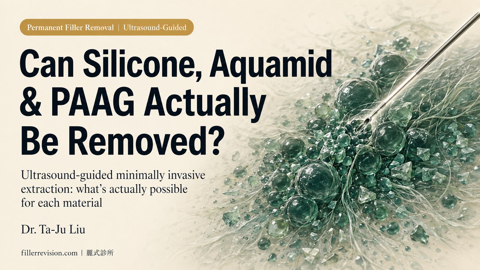 Permanent Filler Removal: Can Silicone, Aquamid, PAAG, and Amazingel Actually Be Extracted?