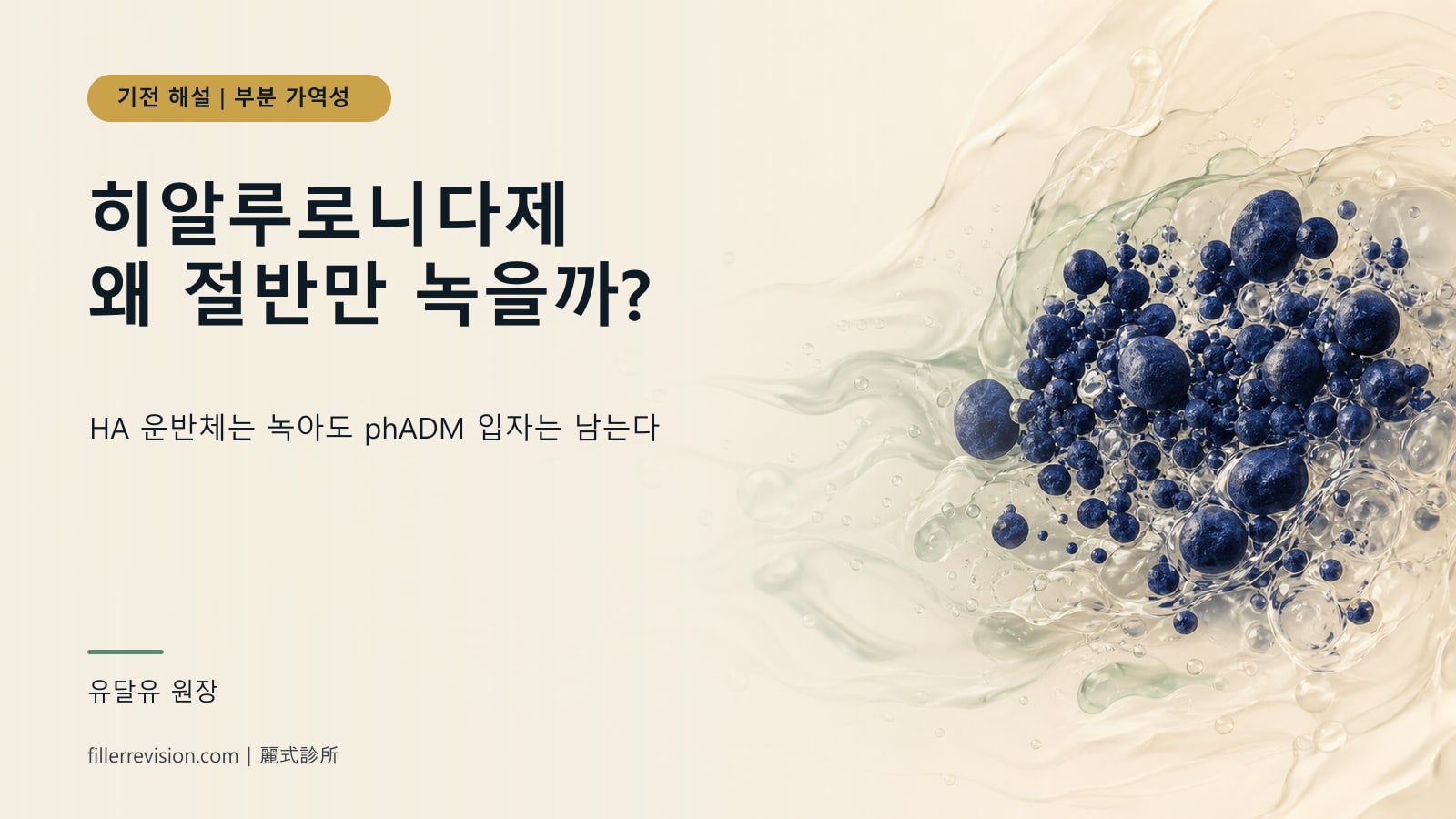 히알루로니다제로 RE2O 결절이 안 없어져요? 왜 절반만 녹는가