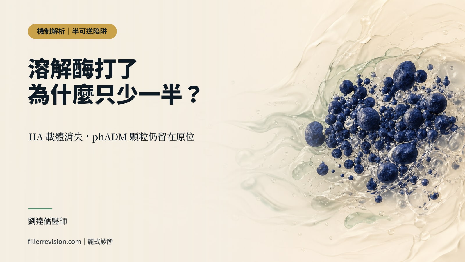 打了溶解酶 RE2O 硬塊還在?為什麼玻尿酸酶只溶得掉一半