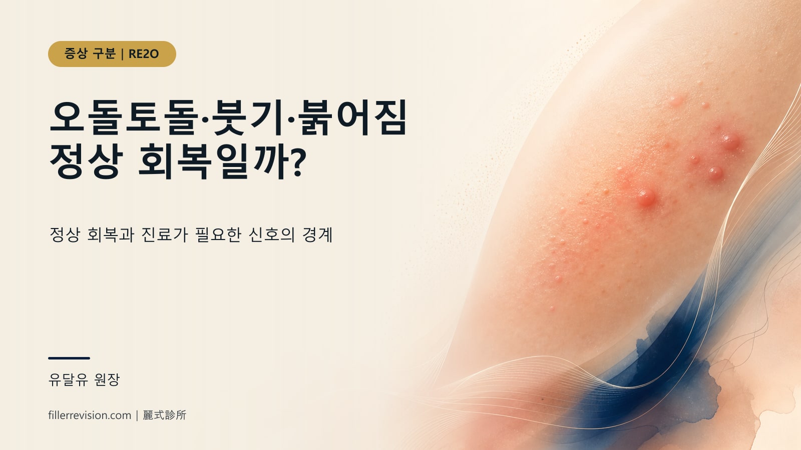 RE2O 물광주사 후 결절·오돌토돌·붉어짐, 정상 회복? 합병증? 구분법