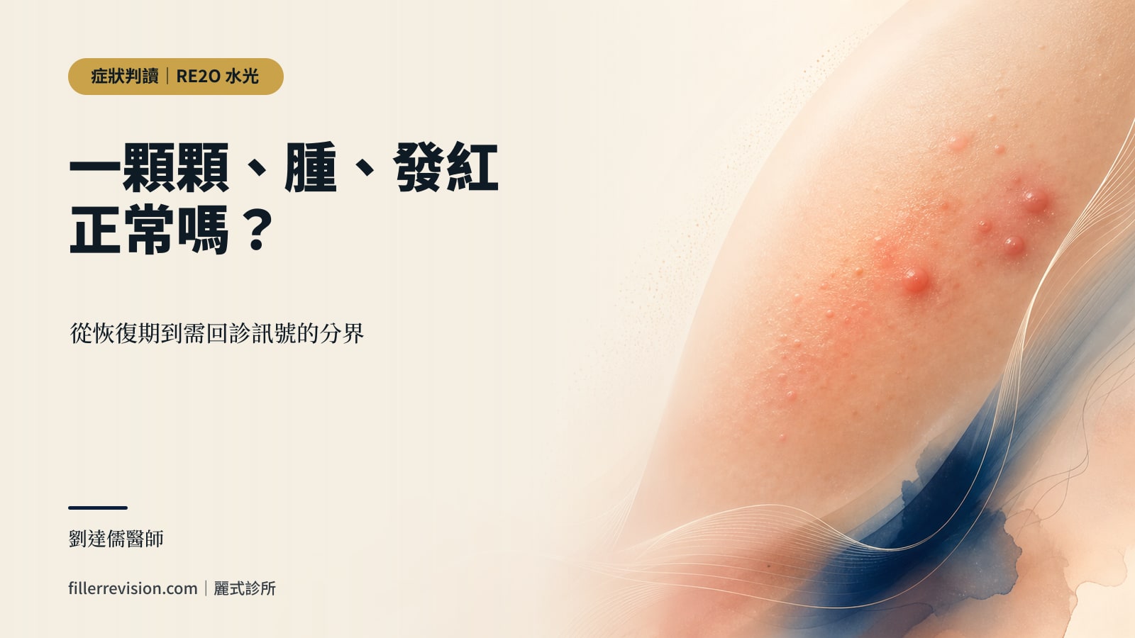 打完 RE2O 水光一顆顆、腫、發紅怎麼辦?正常恢復期和併發症的分界