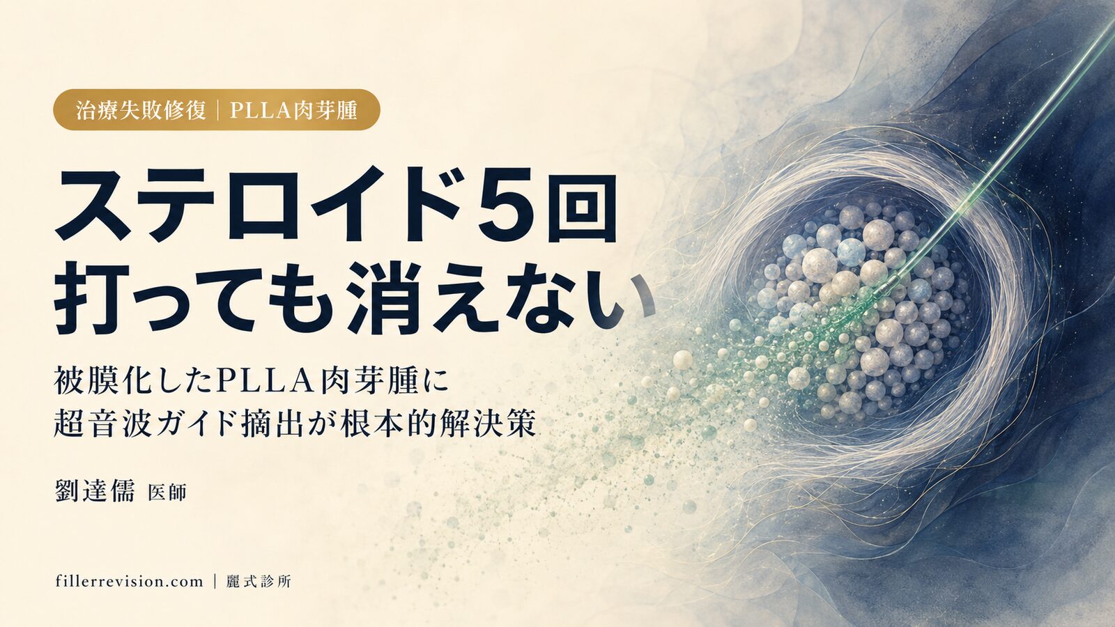 スカルプトラ(舒顏萃)肉芽腫完全ガイド:硬結の見極めからステロイド失敗後の修復選択肢まで