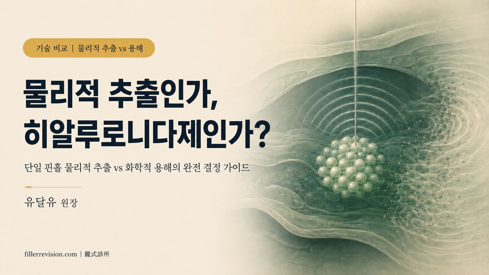 단일 핀홀 물리적 추출 vs 초음파 유도 용해: 두 기술의 완전 비교 가이드