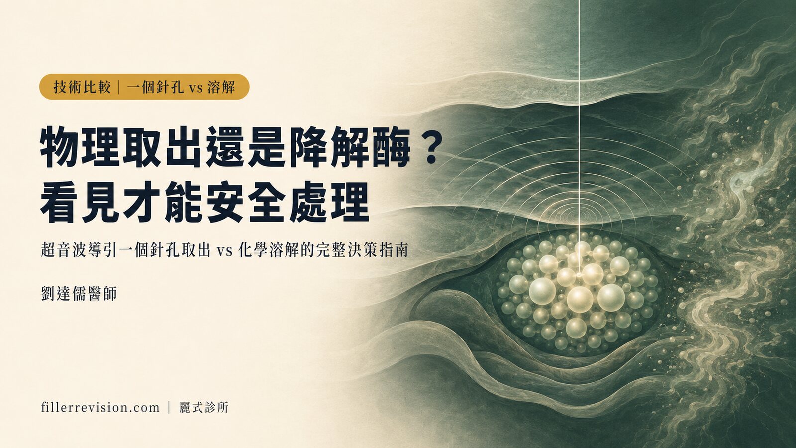 一個針孔物理取出 vs 超音波導引溶解:兩種技術的完整比較指南