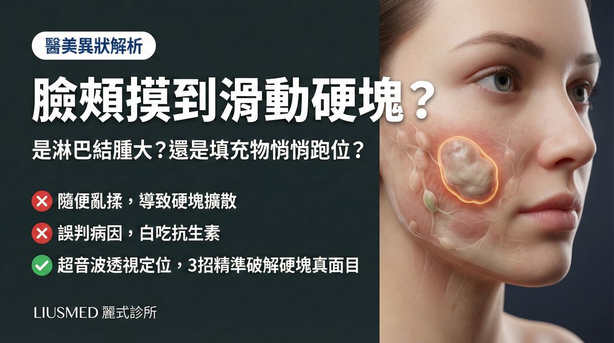 臉上滑動硬塊是淋巴結還是填充物?FILLER REVISION 超音波精準鑑別方案