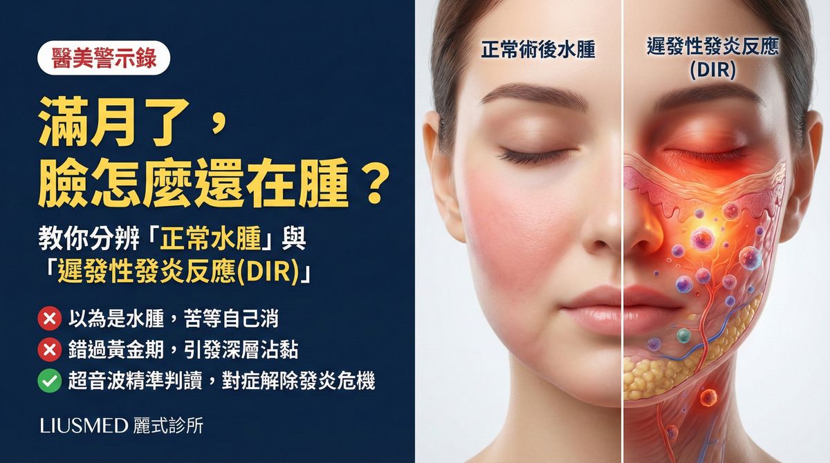 填充物一個月還在腫?FILLER REVISION 教你分辨水腫與遲發性發炎反應