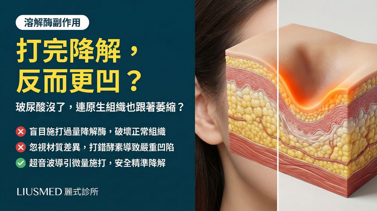 降解酶太陽穴過度溶解凹陷?FILLER REVISION 過度溶解修復方案