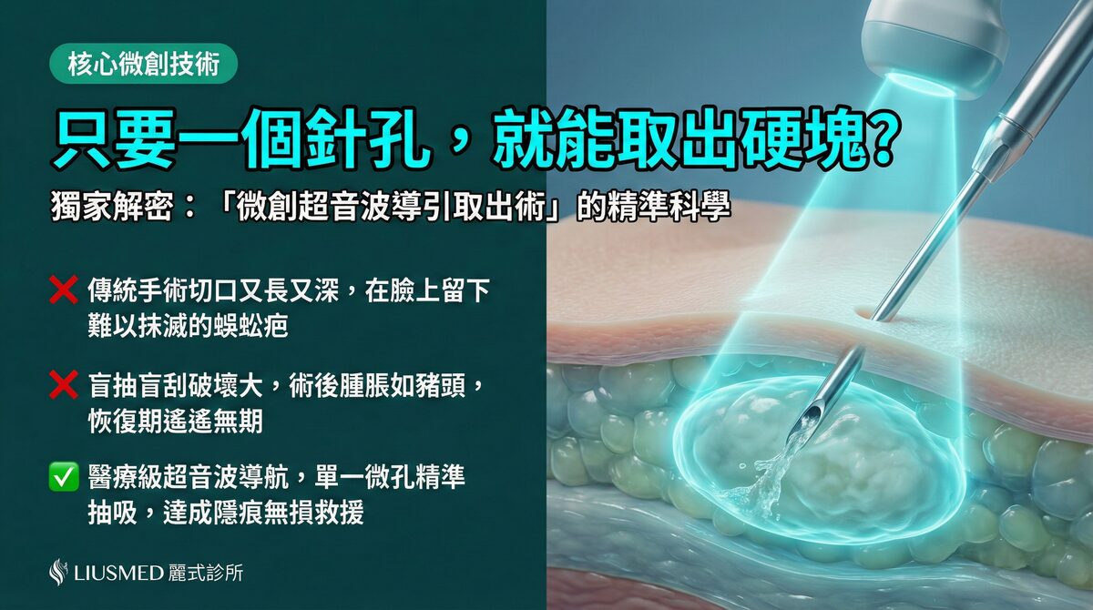 什麼是「微創超音波導引一個針孔取出術」?FILLER REVISION 核心技術解析