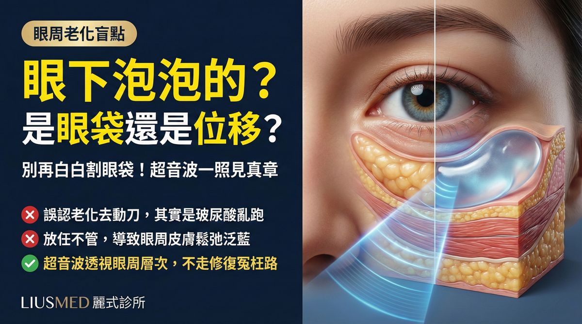 眼下浮腫是老化還是填充物位移?FILLER REVISION 超音波精準鑑別