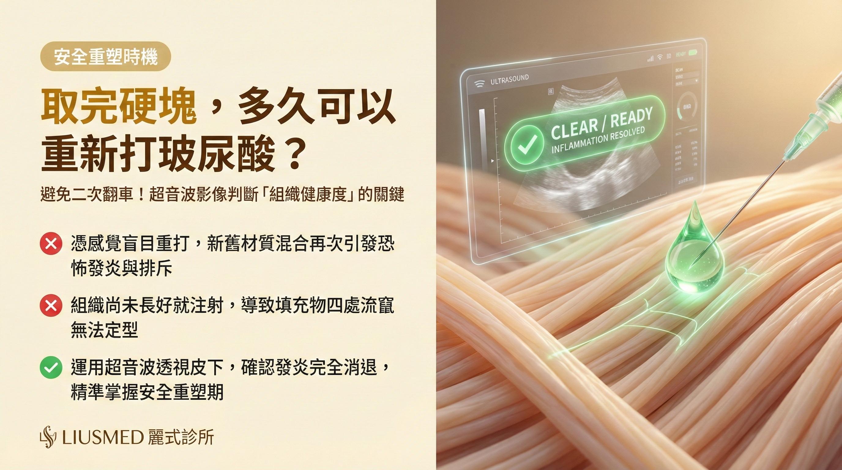 FILLER REVISION 取出後多久可以安全再注射？二次修復患者的時機判斷