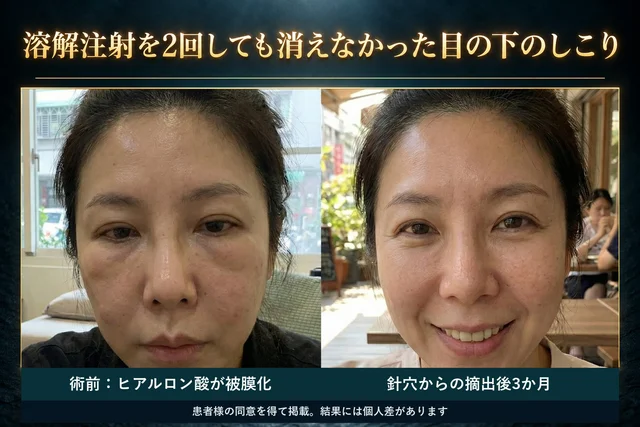 術前