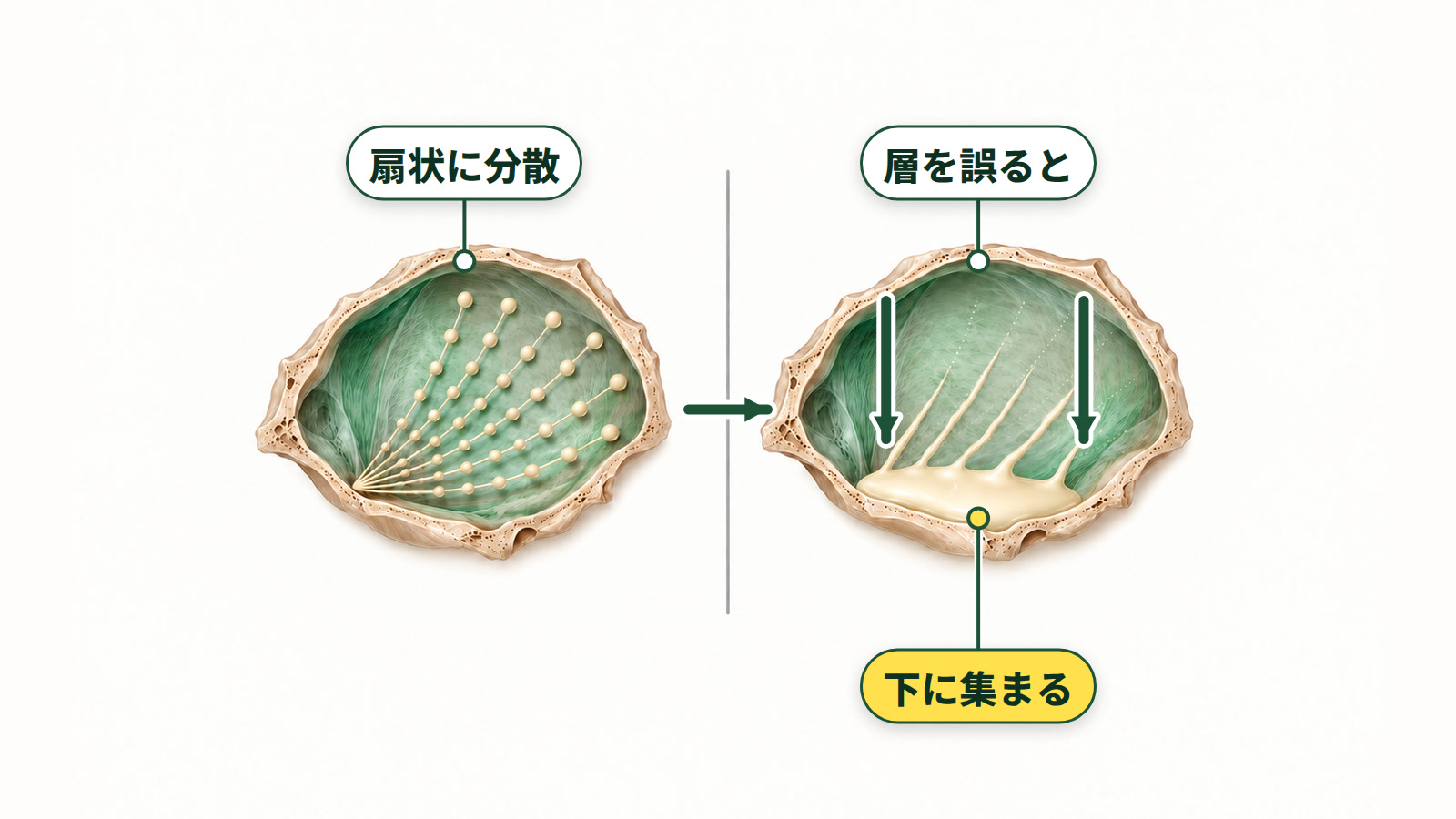 イラスト:左は扇状注入で平面上に分散した状態。右は層を誤った場合で、同じ扇状でも時間がたつとお椀の底に集まります。