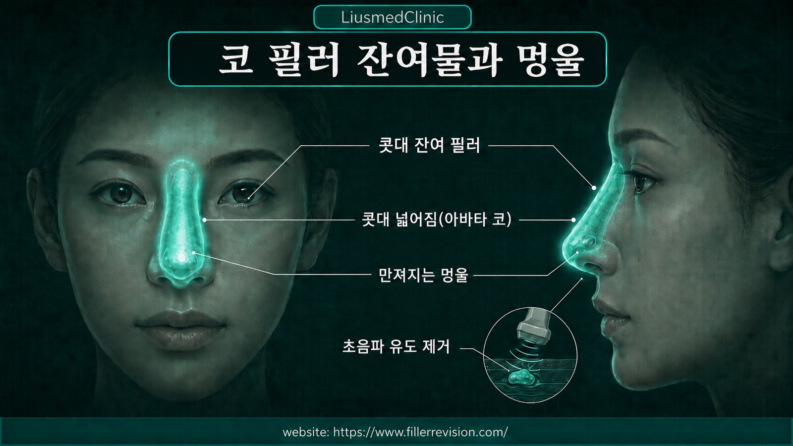코