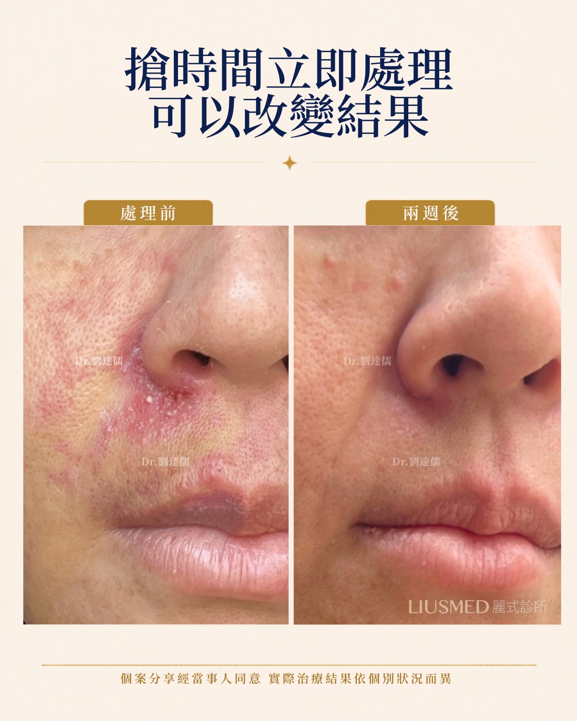 搶時間立即處理 可以改變結果