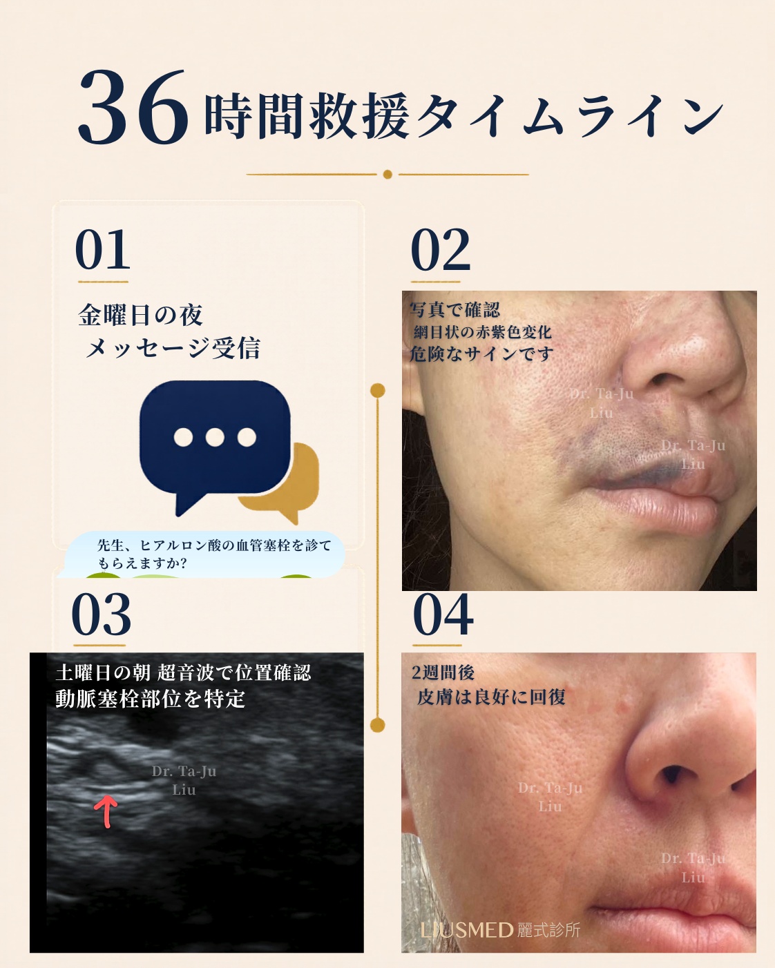 36 時間の救急タイムライン