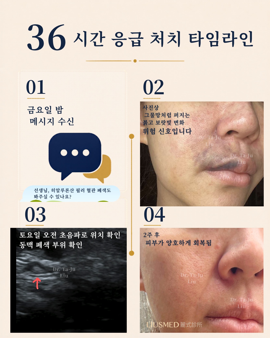 36시간 구조 타임라인