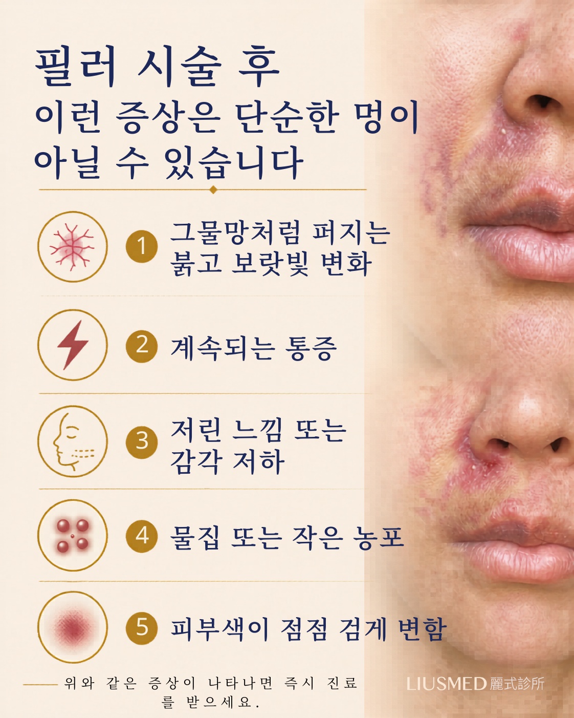 필러 후, 이것은 일반 멍이 아닐 수 있습니다