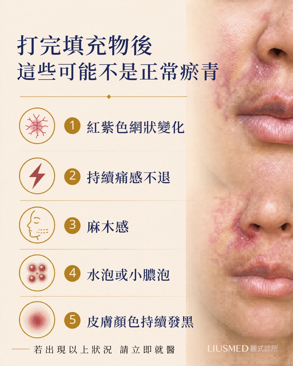 打完填充物後 這些可能不是正常瘀青