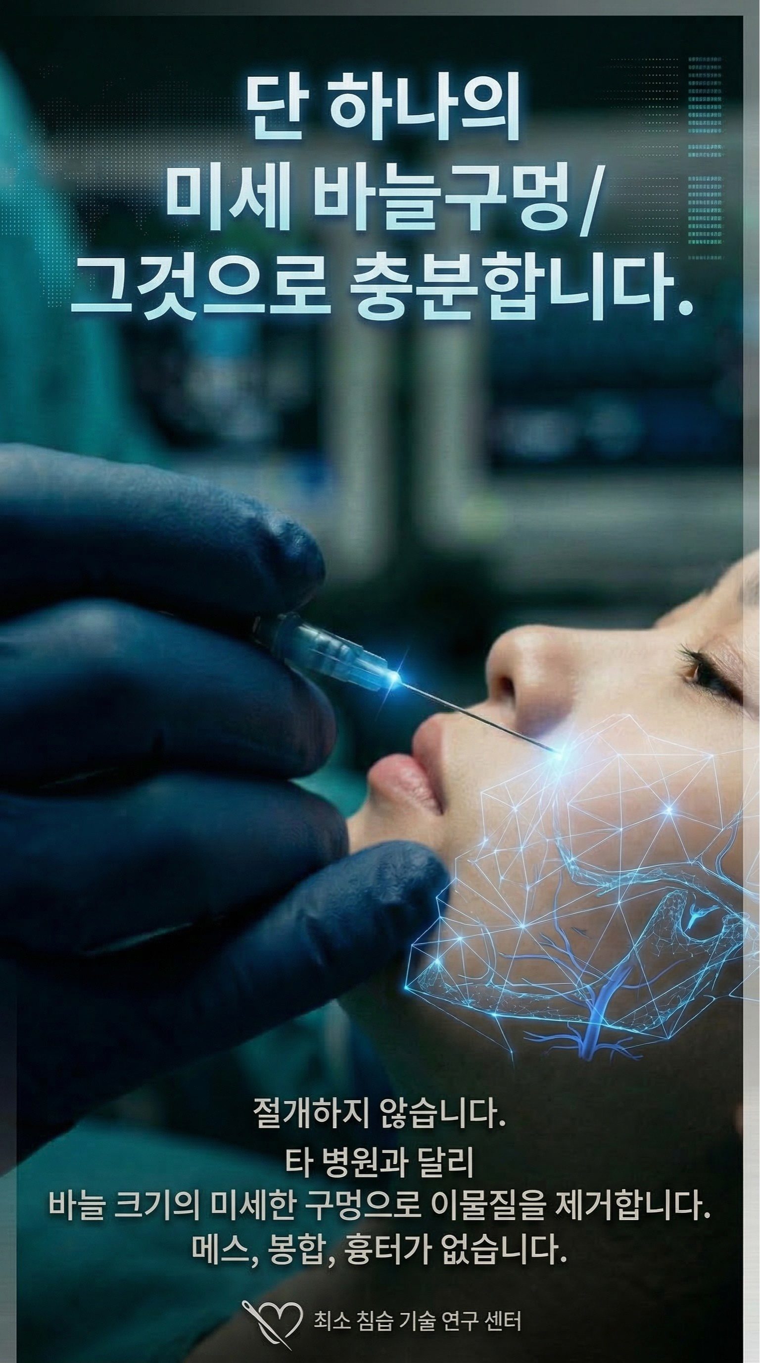 약 2mm 바늘구멍, 절개하지 않습니다 — 초음파로 위치를 확인하고 바늘구멍으로 필러를 제거합니다. 절개도 봉합도 없습니다. 범위가 넓으면 부위와 횟수를 나누지만, 그때도 바늘구멍으로 합니다. 바늘구멍은 약 2주면 아물고, 붓기·멍은 약 2~3주에 가라앉습니다.