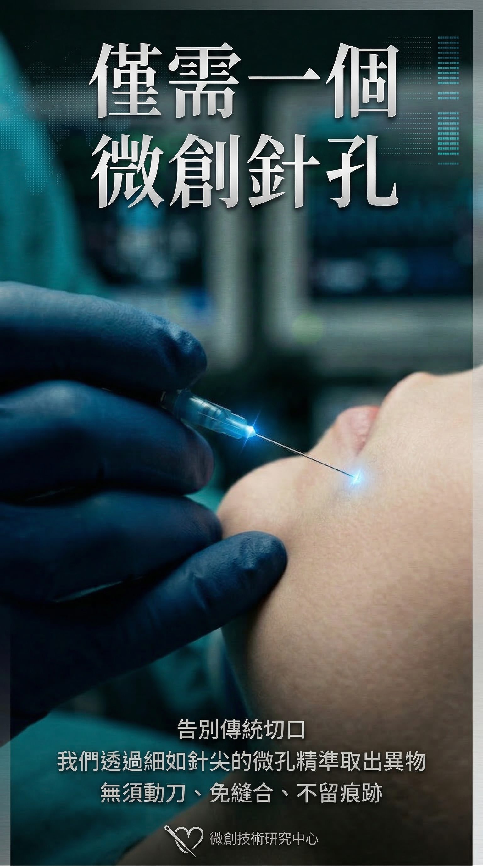 約 2mm 的針孔,不開刀取出 — 超音波看清位置,經針孔取出填充物;無切口、不需縫合。範圍大會分區、分次,仍然是針孔。針孔約 2 週癒合,腫脹瘀青約 2–3 週消退。